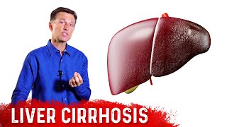 Is Liver Cirrhosis Reversible  Fibrosis vs Cirrhosis – DrBerg [upl. by Wehtta359]