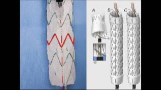 Matrices Conformable for Multiplication in English Saima Academy [upl. by Thun]