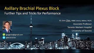 USguided Axillary Brachial Plexus Block  the Simple Guide [upl. by Akcirderf]