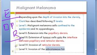 Pathology 763 d Malignant Melanoma Staging Level Clark cancer AJCC [upl. by Av]