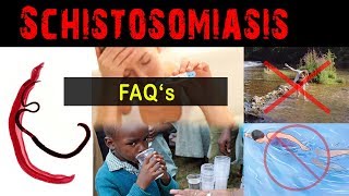 Why amp what is schistosomiasis   FAQ [upl. by Grube]