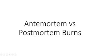 Antemortem vs Postmortem Burns  Forensic Medicine FMT [upl. by Yelram645]