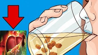 सिर्फ 3 दिन में होगी लिवर की सफाई  LIVER DETOX DRINK IN HINDI  RAISINS WATER किशमिश का पानी [upl. by Nesline]