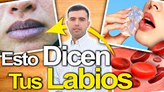 Esto Revelan Tus Labios  Enfermedades Que Muestran Tus Labios Y Cómo Solucionarlo [upl. by Sarazen]