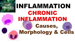 INFLAMMATION 8 CHRONIC INFLAMMATION Causes Morphology amp Cells [upl. by Selemas299]