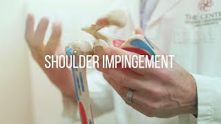 Shoulder Impingement Causes and Treatment [upl. by Aneekat]