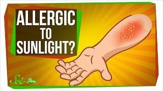 What are the common skin allergies  Dr Sachith Abraham [upl. by Ferren]