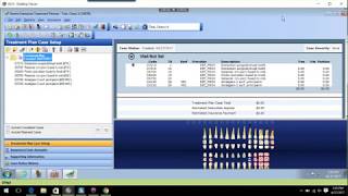 Dentrix Treatment Planner Module [upl. by Alaekim]