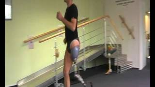 Above knee amputee running on prosthetic leg [upl. by Feirahs815]