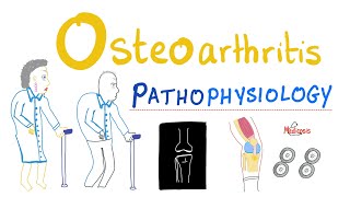 Portal Hypertensive Gastropathy [upl. by Finkelstein]