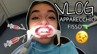 METTO L APPARECCHIO AI DENTI 😢VLOG [upl. by Anattar]