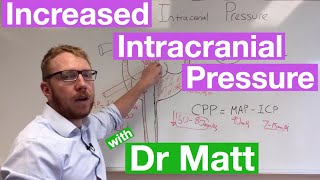 Increased Intracranial Pressure [upl. by Senior]