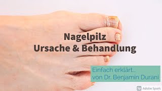 Nagelpilz Ursache amp Behandlung  Einfach erklärt mit Dr Durani Facharzt für Hautkrankheiten [upl. by Nired]