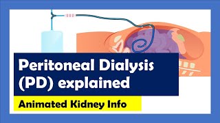 Peritoneal Dialysis explained [upl. by Johna]