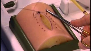 Simple Interrupted wound closure [upl. by Notak]