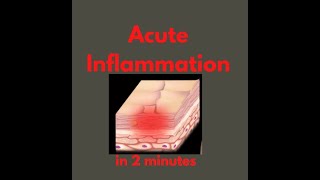 Acute inflammation in 2 mins [upl. by Ezitram]