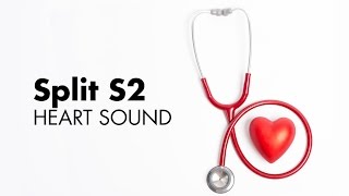 Fixed Split S2  Heart Sounds  MEDZCOOL [upl. by Ahsimek]