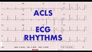 ACLS  ECG rhythm recognition amp management Part 1 [upl. by Grail]