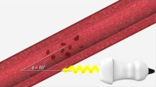 Ultrasound Physics  Explaining Doppler [upl. by Hanoj847]