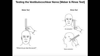 Interpreting the WeberRinne Tests EXPLAINED [upl. by Yves]