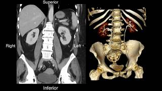 Nephrology  Kidney and Nephron Overview [upl. by Cristionna]