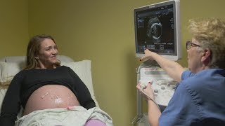 Ultrasounds during pregnancy [upl. by Ahseined113]