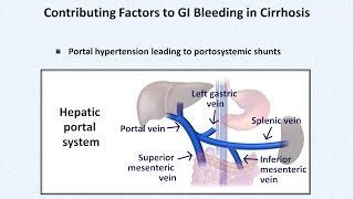 Chronic Active Gastritis  Histopathology [upl. by Htessil116]