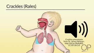 Respiratory Assessment by B Leary L DelSignore  OPENPediatrics [upl. by Eisso706]