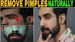 How to Remove PIMPLE NATURALLY FAST REALITY  Acne treatment TheFormalEdit  Hindi [upl. by Warwick]