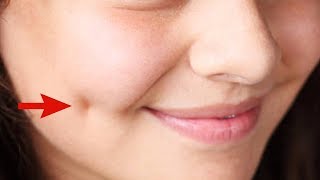 How To Get Dimples Fast And Naturally Beauty Tips [upl. by Polinski]