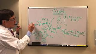 CN VI Palsy [upl. by Schear]