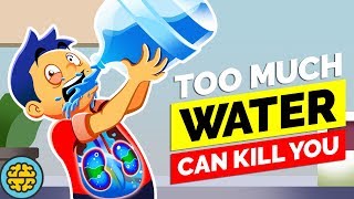 Drinking This Much Water Will Poison You [upl. by Rustice731]