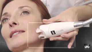 LPG Endermologie technology for the Face  Endermolift [upl. by Virgilio742]