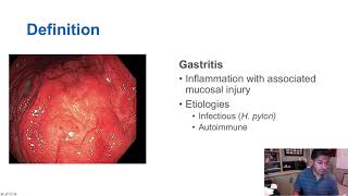 GORD GERD Gastro Oesophageal Reflux Disease  Overview pathophysiology treatment [upl. by Nylleoj]