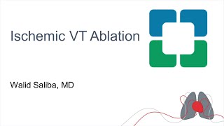 Ischemic VT Ablation [upl. by Fielding]