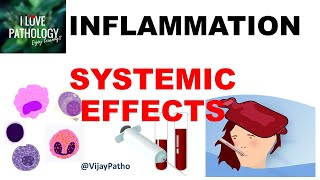 INFLAMMATION Part 10 Systemic effects of Inflammation [upl. by Pros160]