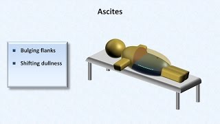 Cirrhosis  Physical Findings [upl. by Atinuahs]