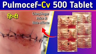 Pulmocef Cv 500 Tablet  Cefuroxime axetil Tablets Review in Hindi  by Mt discuss [upl. by Aihsotal]