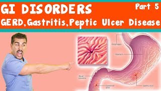 ECE2bPathology of EsophagusGERDErosive esophagitis [upl. by Oilut]