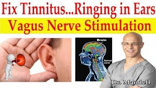 Fix Tinnitus Ringing in Ears Major Breakthrough How to Stimulate Vagus Nerve  Dr Alan Mandell DC [upl. by Ardnaxila]