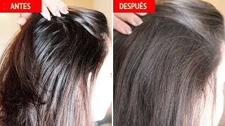 REMEDIO CASERO PARA CABELLO GRASO [upl. by Azilef]