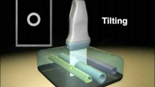 Ultrasound Transducer Manipulation [upl. by Bohaty]