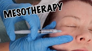 Mesotherapy Facial  Anti Aging Treatment [upl. by Netsirt]