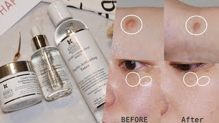 【合作】殘酷考驗！7天Kiehls淡斑挑戰｜Get rid of Dark Spot in 7 Days｜Nabibuzz娜比 [upl. by Lussi296]