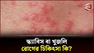 স্ক্যাবিস বা খুজলি রোগের চিকিৎসা কি  Scabies Treatment  Skin Care  Channel 24 [upl. by Pettiford]