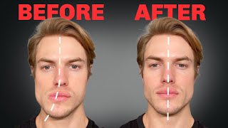 How to Fix Asymmetrical Jaw amp Face FOREVER [upl. by Eemia]