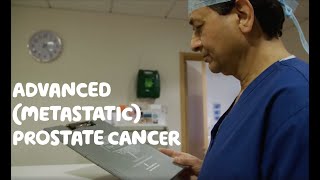 About Advanced Metastatic Prostate Cancer [upl. by Einahteb]