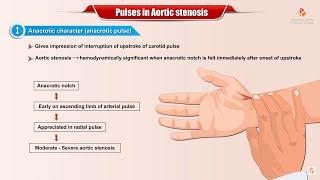 PULSES IN AORTIC STENOSIS  Usmle Cardiology [upl. by Robma]