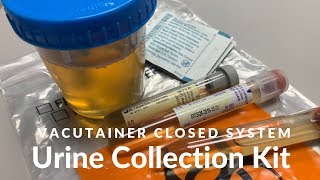 Vacutainer Urine Collection [upl. by Ecenahs]