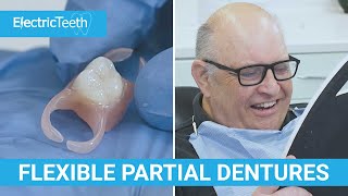 Flexible dentures amp false teeth explained [upl. by Nyleek322]